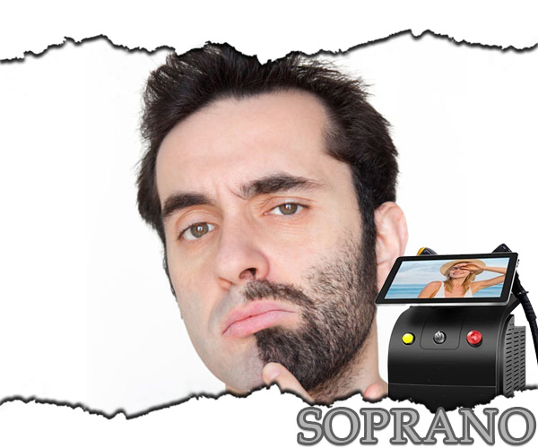 Epilare definitiva facial integral - Soprano
