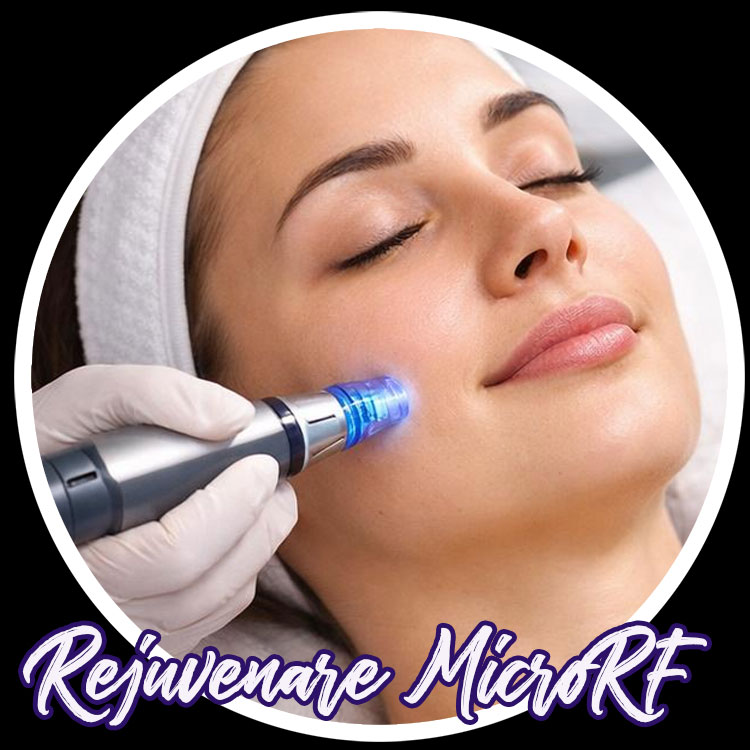 Rejuvenare faciala cu MicroRF