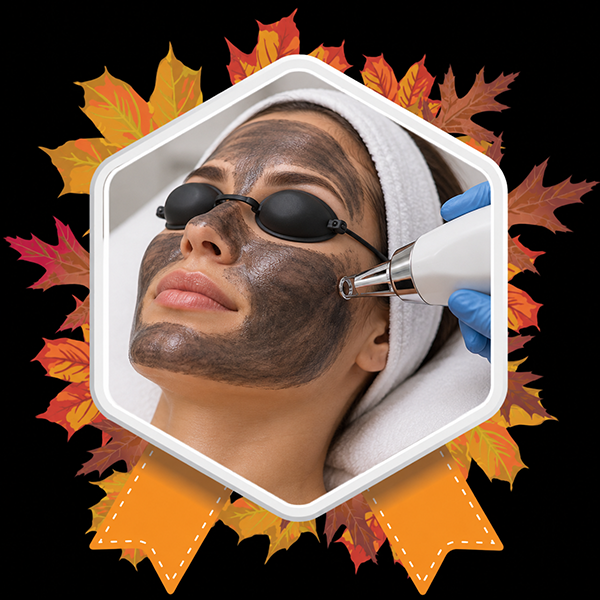 Carbon Peel