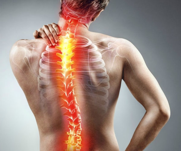 Terapia coloanei vertebrale