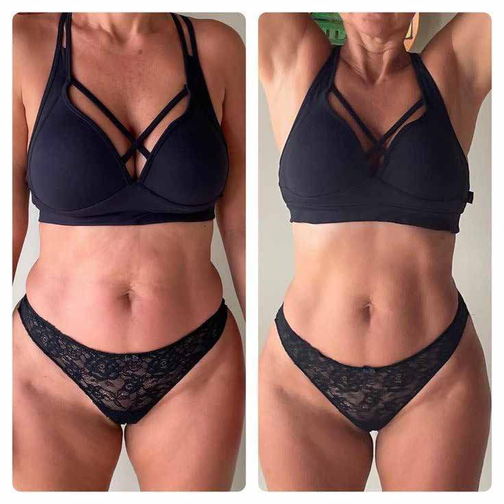 Jordi Shape - cura abdomen si talie x6